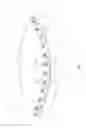Fig. 06 - Replacement heart valve implant