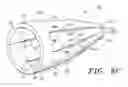 Fig. 08 - Prosthetic tissue valves and methods for replacing native atrioventricular valves with same