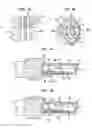 Fig. 07 - Transapical mitral valve delivery system