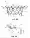 Fig. 06 - Heart valve delivery systems and methods