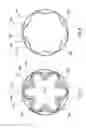 Fig. 07 - Venous valve prostheses