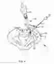Fig. 04 - Systems for and methods of preparing and fusing a sacroiliac joint