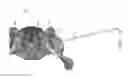 Fig. 110 - Systems for and methods of preparing and fusing a sacroiliac joint