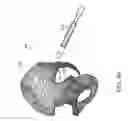 Fig. 64 - Systems for and methods of preparing and fusing a sacroiliac joint