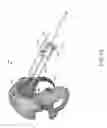 Fig. 84 - Systems for and methods of preparing and fusing a sacroiliac joint