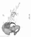 Fig. 86 - Systems for and methods of preparing and fusing a sacroiliac joint
