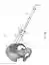 Fig. 89 - Systems for and methods of preparing and fusing a sacroiliac joint