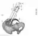 Fig. 91 - Systems for and methods of preparing and fusing a sacroiliac joint