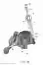 Fig. 95 - Systems for and methods of preparing and fusing a sacroiliac joint