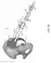 Fig. 96 - Systems for and methods of preparing and fusing a sacroiliac joint