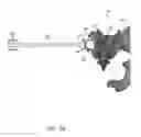Fig. 99 - Systems for and methods of preparing and fusing a sacroiliac joint