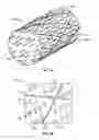 Fig. 04 - Monolithic medical devices, methods of making and using the same