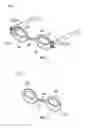 Fig. 03 - Eyelid treatment device and associated methods