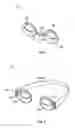 Fig. 04 - Eyelid treatment device and associated methods