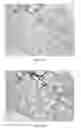 Fig. 02 - COMPOSITIONS AND METHODS FOR TREATMENT OF SHORT TELOMERE DISORDERS