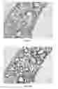 Fig. 06 - COMPOSITIONS AND METHODS FOR TREATMENT OF SHORT TELOMERE DISORDERS