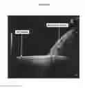 Fig. 10 - Methods and compositions for producing hepatocyte-like cells