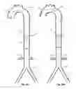 Fig. 23 - Intra-aortic balloon apparatus, assist devices and methods for improving flow, counterpulsation and haemodynamics