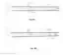 Fig. 28 - Intra-aortic balloon apparatus, assist devices and methods for improving flow, counterpulsation and haemodynamics