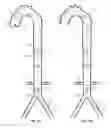 Fig. 30 - Intra-aortic balloon apparatus, assist devices and methods for improving flow, counterpulsation and haemodynamics