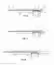 Fig. 05 - Device and methods for transvascular tumor embolization