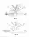 Fig. 09 - Device and methods for transvascular tumor embolization