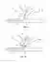 Fig. 10 - Device and methods for transvascular tumor embolization