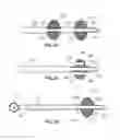 Fig. 22 - Device and methods for transvascular tumor embolization