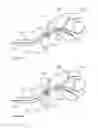 Fig. 34 - Device and methods for transvascular tumor embolization