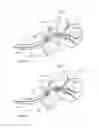 Fig. 35 - Device and methods for transvascular tumor embolization