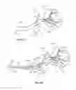 Fig. 43 - Device and methods for transvascular tumor embolization