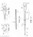 Fig. 03 - CATHETER APPARATUS WITH TELESCOPING LUMEN CATHETERS AND ITS USE IN METHODS FOR TREATING VASCULATURES