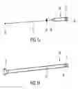 Fig. 04 - CATHETER APPARATUS WITH TELESCOPING LUMEN CATHETERS AND ITS USE IN METHODS FOR TREATING VASCULATURES