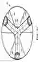 Fig. 20 - CATHETER APPARATUS WITH TELESCOPING LUMEN CATHETERS AND ITS USE IN METHODS FOR TREATING VASCULATURES