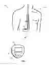 Fig. 02 - AUTOMATIC THERAPY ADJUSTMENTS
