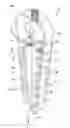 Fig. 01 - Elevator load bearing termination assembly for carbon fiber belt