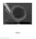 Fig. 07 - TREATMENT OF URINE