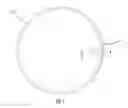 Fig. 02 - VALVE ASSEMBLY FOR EXPANDABLE BLADDER AND METHOD OF MANUFACTURING THE SAME