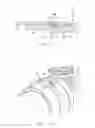 Fig. 07 - System, method and apparatus for debris shield for squeeze-activated retainer for a conduit