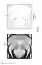 Fig. 11 - Apparatus, system, and method for interior fluid flow with optimized fin structures