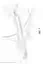 Fig. 02 - Airplane takeoff trims utilizing both stabilizers and elevators