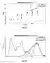 Fig. 41 - Adaptive asymmetrical signal detection and synthesis methods and systems