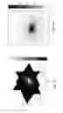 Fig. 06 - Magnetic resonance image analysis method and method for evaluating the risks of radiotherapy
