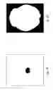 Fig. 07 - Magnetic resonance image analysis method and method for evaluating the risks of radiotherapy