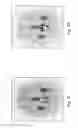 Fig. 08 - Magnetic resonance image analysis method and method for evaluating the risks of radiotherapy
