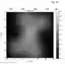 Fig. 12 - Method for irradiating a target using restricted placement grids