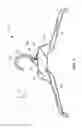 Fig. 02 - Garment hanger used with dual sizers