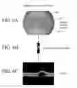 Fig. 07 - Optical coherence tomography-based ophthalmic testing methods, devices and systems