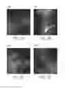 Fig. 02 - IMAGING SYSTEMS AND METHODS FOR TISSUE DIFFERENTIATION, E.G., FOR INTRAOPERATIVE VISUALIZATION