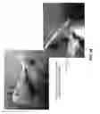 Fig. 44 - Wireless optofluidic systems for programmable in vivo pharmacology and optogenetics